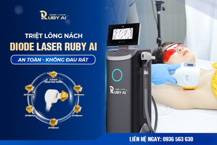 Triệt lông nách công nghệ Ruby AI tại SVIET SPA