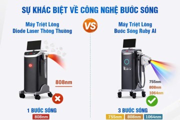 Diode Ruby AI khác gì các dòng triệt lông Diode khác trên thị trường?