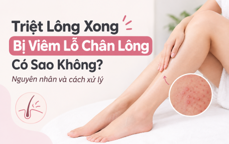 Triệt Lông Xong Bị Viêm Lỗ Chân Lông: Nguyên Nhân Và Cách Xử Lý