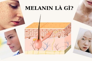 Melanin Hấp Thụ Ánh Sáng Là Gì? Cơ Chế Gây Nám Da Và Ứng Dụng Trong Điều Trị Sắc Tố