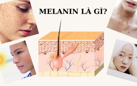 Melanin Hấp Thụ Ánh Sáng Là Gì? Cơ Chế Gây Nám Da Và Ứng Dụng Trong Điều Trị Sắc Tố