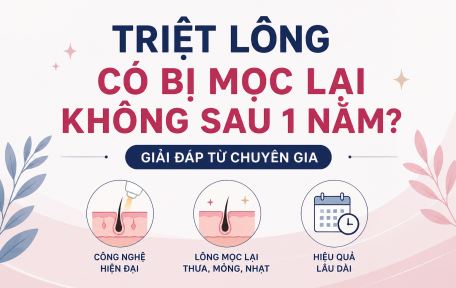 Triệt Lông Có Bị Mọc Lại Không Sau 1 Năm? Sự Thật Nhiều Người Chưa Biết