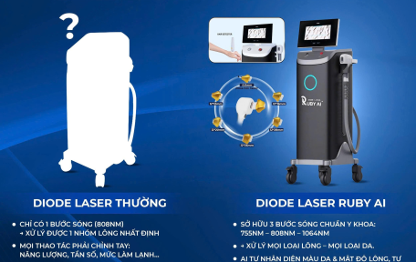 Công nghệ triệt lông Ruby AI Có thật sự tốt không ?