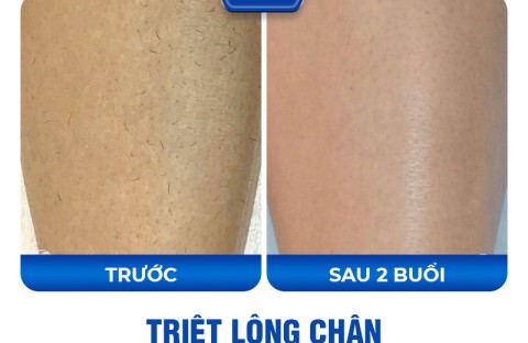 Chị Thanh Hà Nội