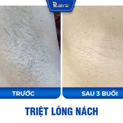 Chị Quỳnh Quỳnh