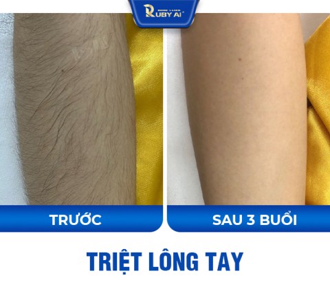 Chị Thảo Mai