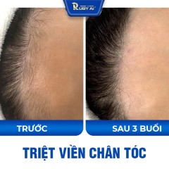 Chị Quỳnh Trần