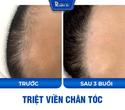 Chị Quỳnh Trần