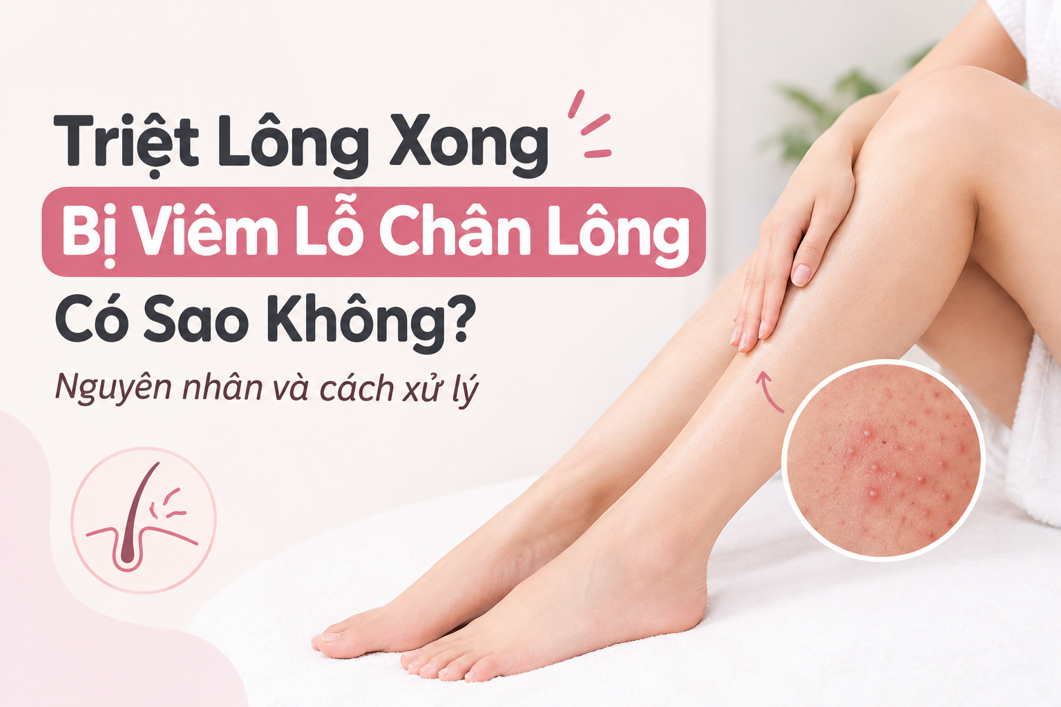 Cách xử lý khi triệt lông bị viêm lỗ chân lông