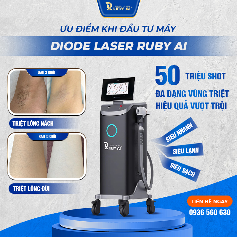Công Nghệ Diode Laser Ruby AI Là Gì? 3 Bước song Xu Hướng Triệt Lông 2025?