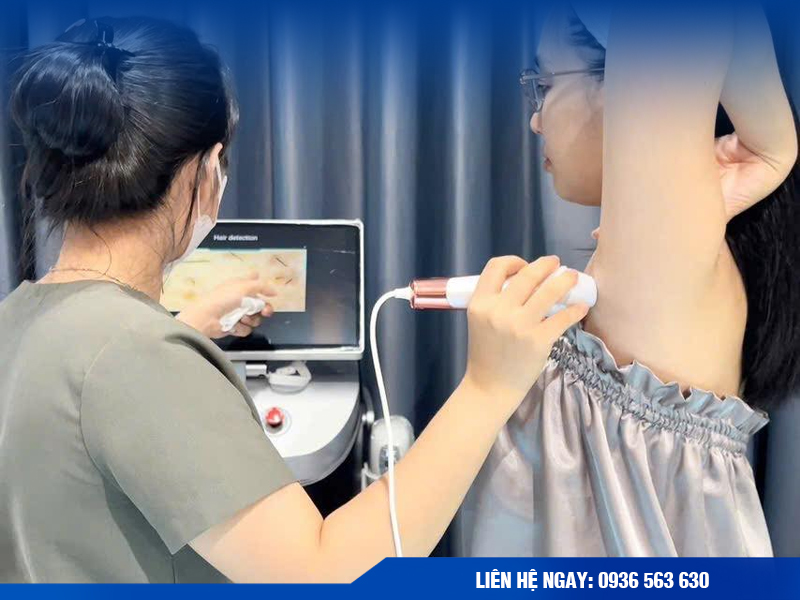 Dịch vụ triệt lông nách