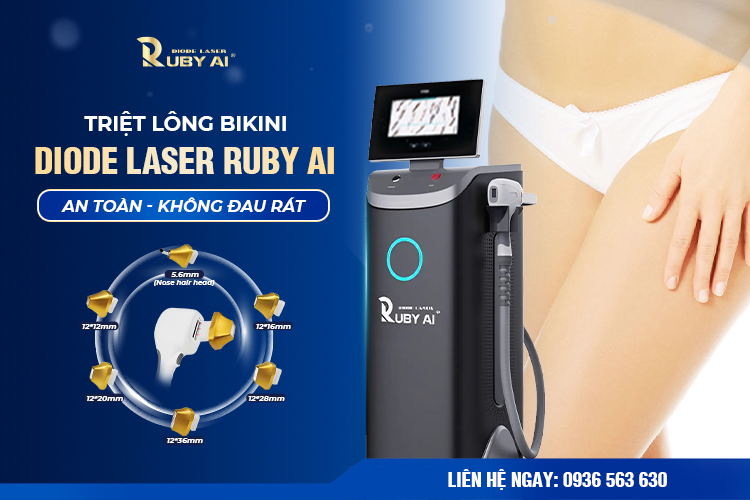 khách hàng sau khi Triệt lông bikini  bằng công nghệ ruby AI