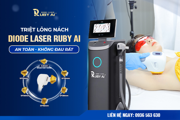 Dịch vụ triệt lông nách