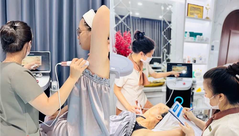 Máy triệt lông Diode Laser Ruby AI tai Sviet Spa