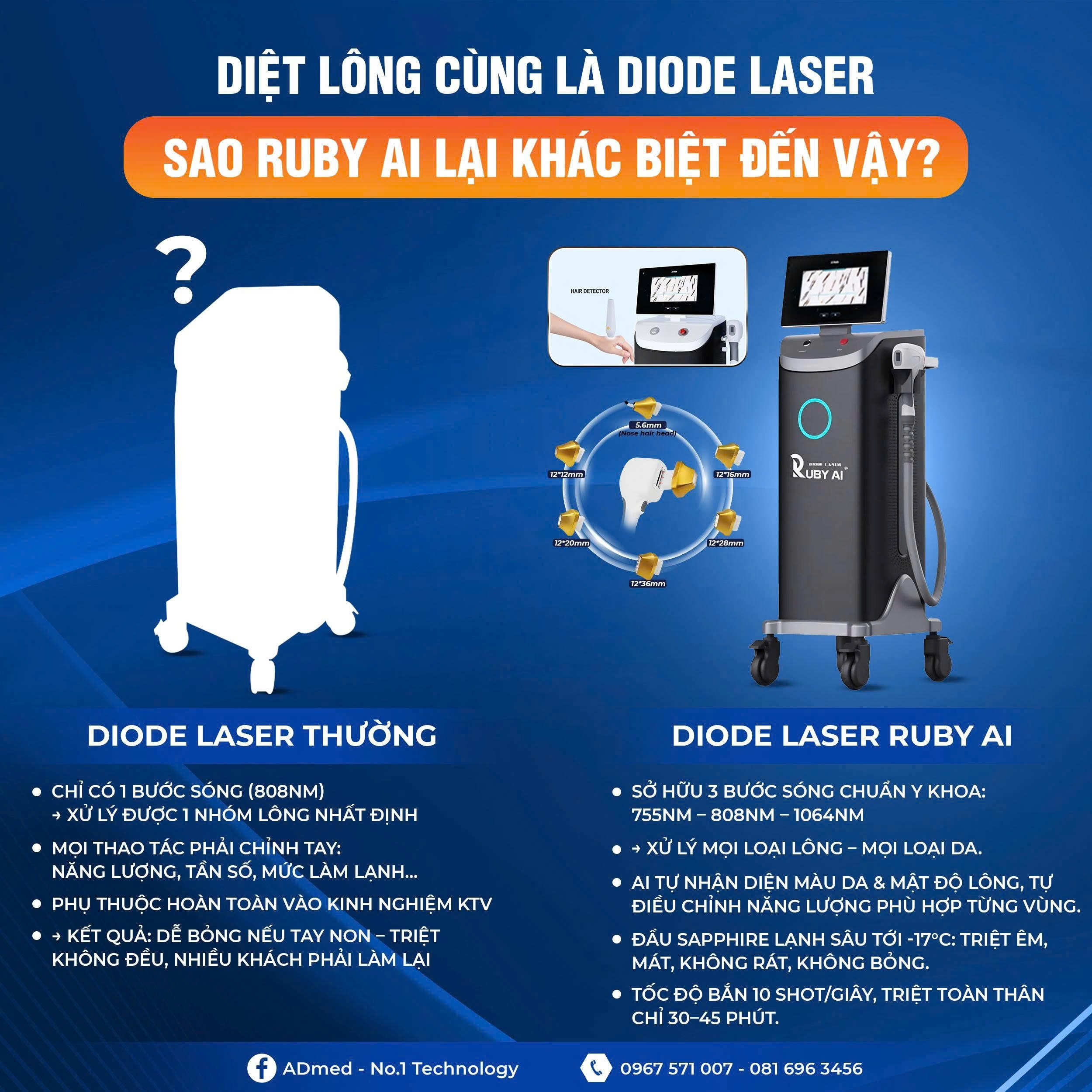 Máy triệt lông công nghệ cao ruby ai